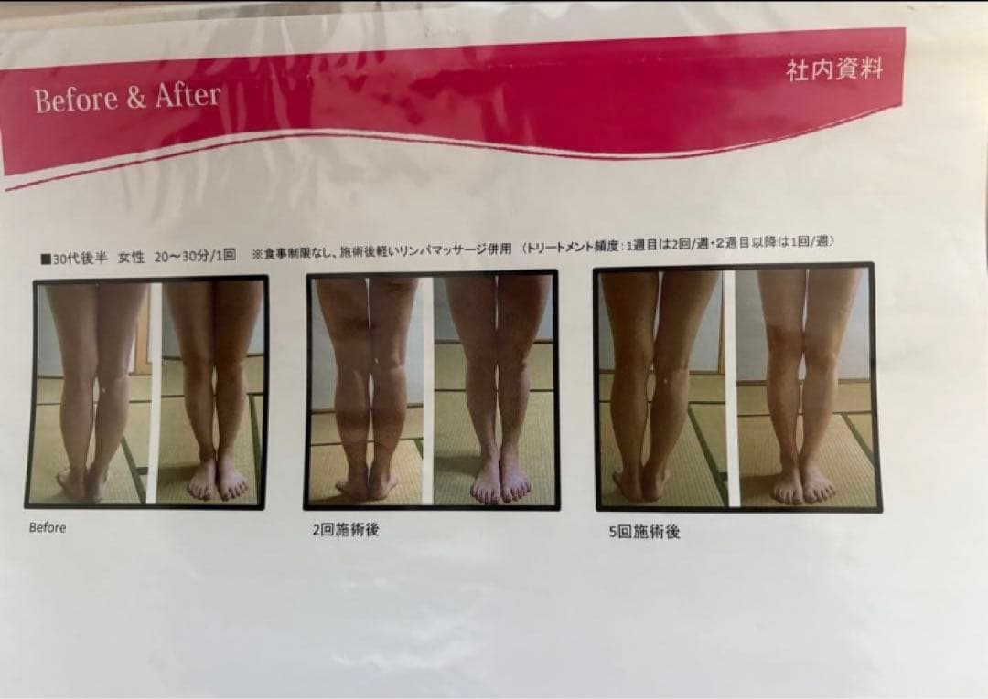 大手エステサロン導入品　業務用　キャビコンパクト　朝まで価格