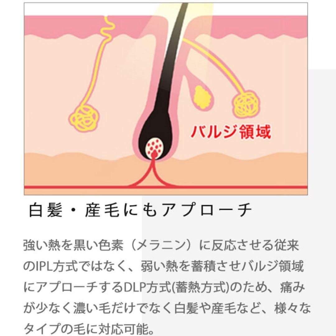 レディッチ