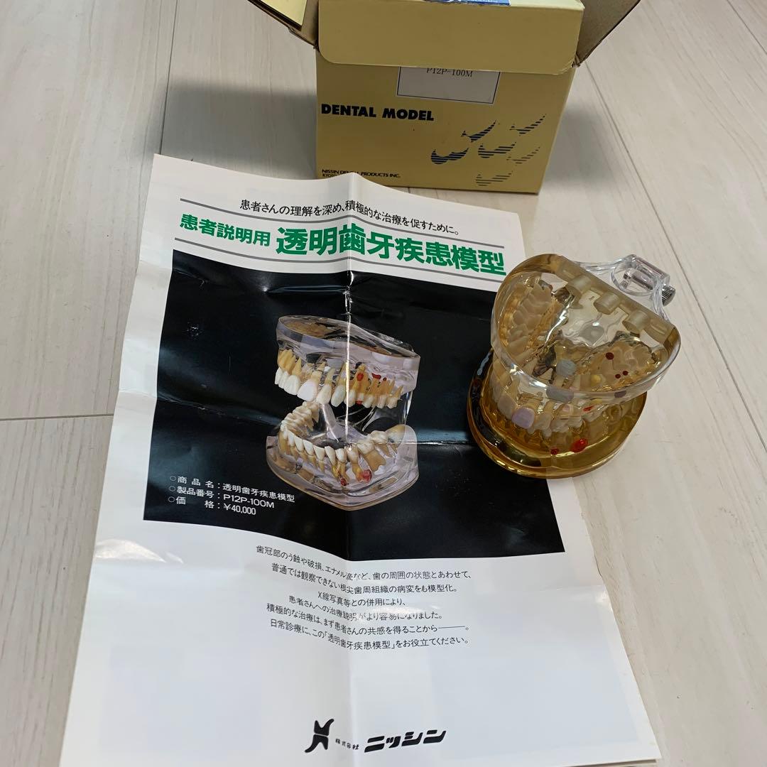 透明歯牙疾患模型